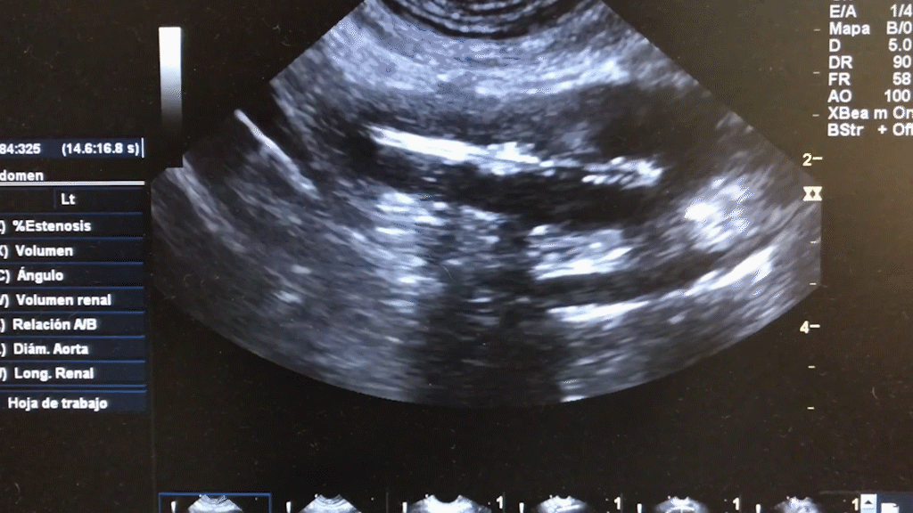 ecografia-abdominal