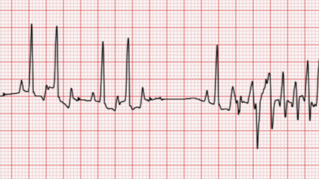 electro-cardiograma-veterinario